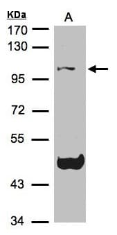 NALP3 / NLRP3 Antibody (aa974-1036)