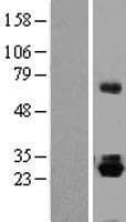 TRH Protein (Over-Expression Lysate Myc-DDK (Flag))