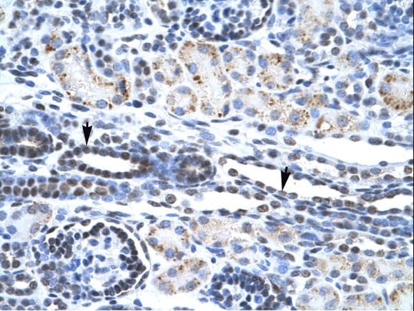 ETS1 / ETS-1 Antibody (aa52-101)