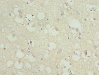 Anillin Antibody