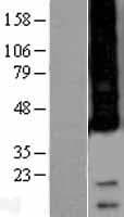 APH1A / APH-1 Protein (Over-Expression Lysate Myc-DDK (Flag))