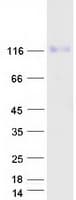 Human UNC5H2 / UNC5B Protein (Recombinant Myc-DDK (Flag))