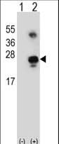 GADD45A / GADD45 Antibody (aa133-165)