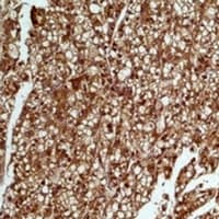 Monoclonal Mouse anti-Human SMAD3 Antibody (IHC, WB)