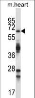 TRIM45 Antibody (aa389-417)