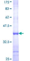 Human AOC2 / SSAO Protein (Recombinant GST, N-terminus)
