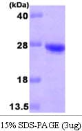 Human CDO1 / Cysteine Dioxygenase Protein (Recombinant His)