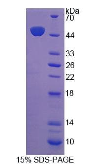 Human PTPN14 / PEZ Protein (Recombinant His-GST, N-terminus)