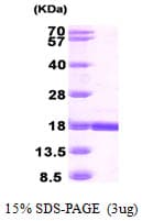 Human CRBPIV / RBP7 Protein (Recombinant His)