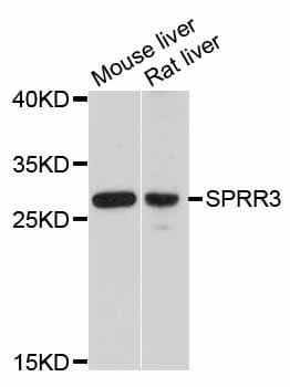 Polyclonal Rabbit anti-Human SPRR3 Antibody (WB)