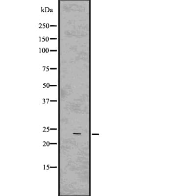 RAB7A / RAB7 Antibody