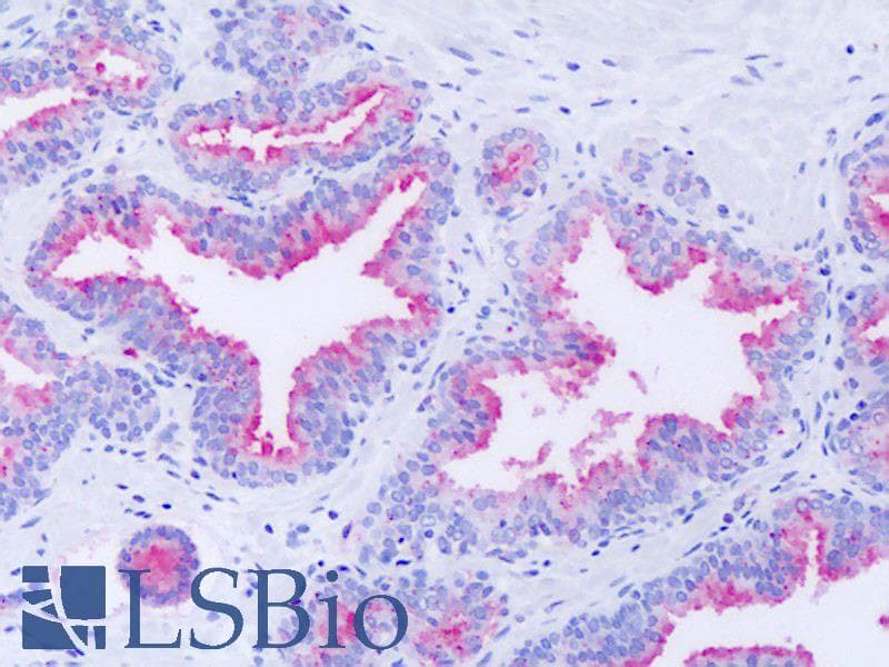 IHC-plus™ Polyclonal Rabbit anti-Human GPR63 Antibody (Extracellular Domain, IHC)