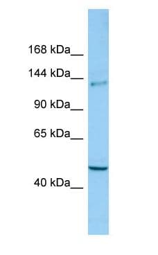 Polyclonal Rabbit anti-Human CLASP2 Antibody (C-Terminus, WB)