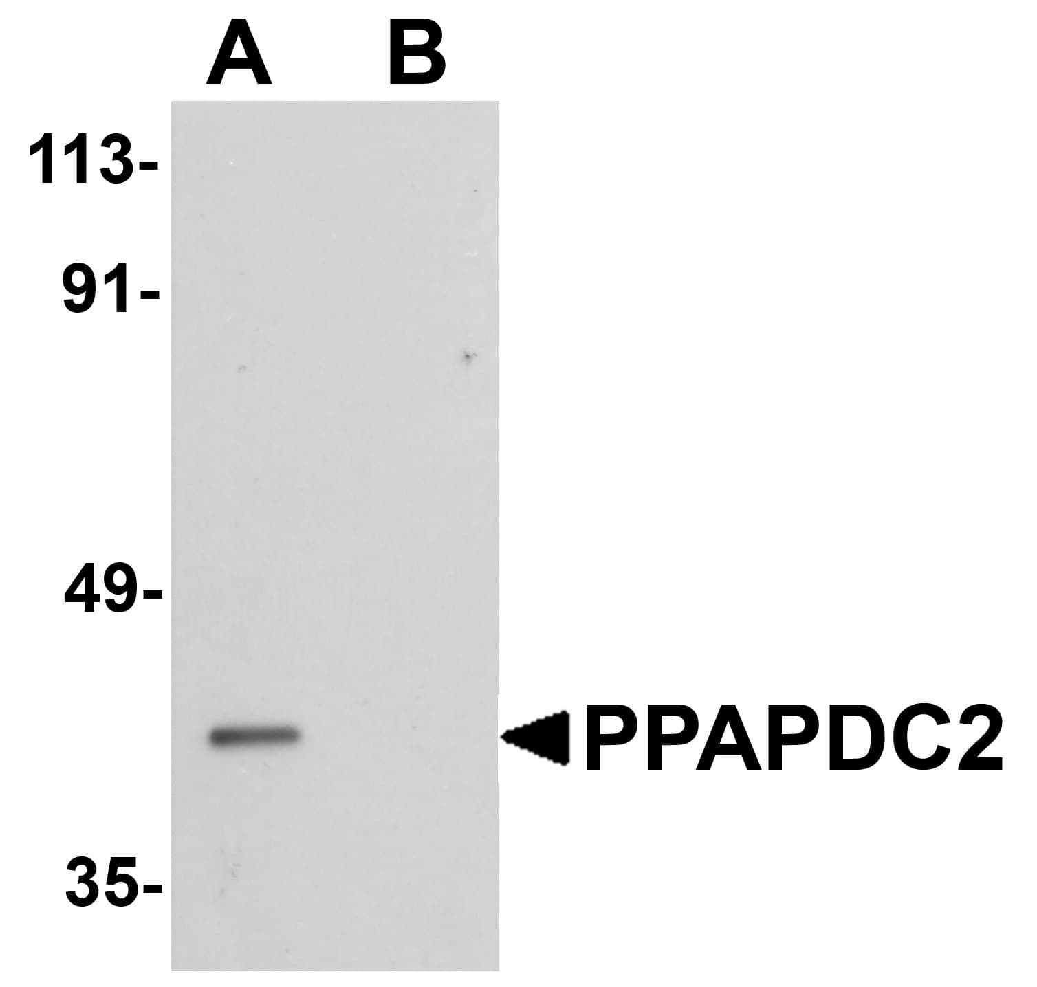 IHC-plus™ Polyclonal Rabbit anti-Human PPAPDC2 Antibody (IHC, IF, WB)