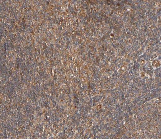 PLCG2 / PLC Gamma 2 Antibody (phospho-Tyr753)