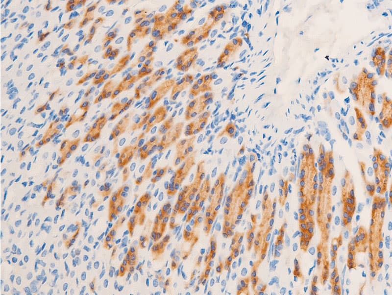 NR3C1/Glucocorticoid Receptor Antibody (phospho-Ser211)
