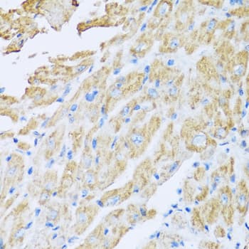 Polyclonal Rabbit anti-Human IL18BP Antibody (IHC, IF, WB)