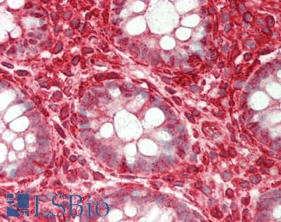 Polyclonal Rabbit anti-Human ST3GAL4 / ST3Gal IV Antibody (aa171-220, IHC, WB)