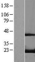 RFK Protein (Over-Expression Lysate Myc-DDK (Flag))