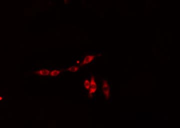 RIOK3 Antibody