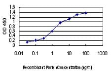 IHC-plus™ Monoclonal Mouse anti-Human MAP2K3 / MEK3 / MKK3 Antibody (clone 1D10, IHC, WB)