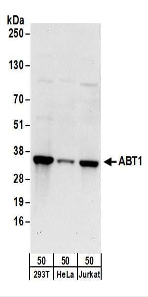 HABT1 / ABT1 Antibody (aa1-50)