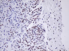 MORF4 Antibody (aa1-255, clone OTI5F2, Carrier-free)