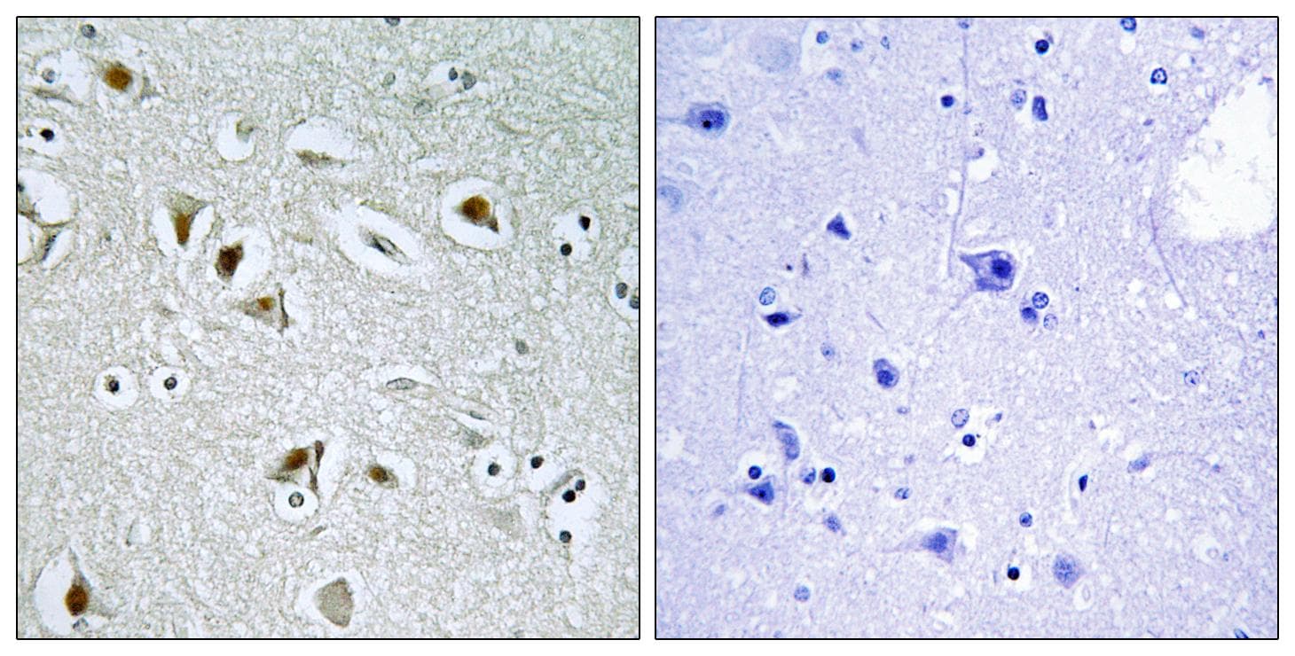 Polyclonal Rabbit anti-Human CDK2AP2 Antibody (IHC)