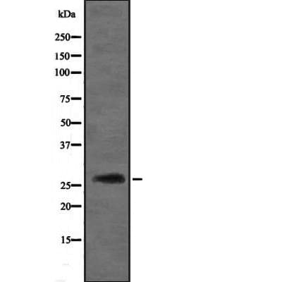 Polyclonal Rabbit anti-Human DIRAS3 / ARHI Antibody (IHC, WB)