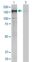 NCAPD2 Antibody (clone 4C12)