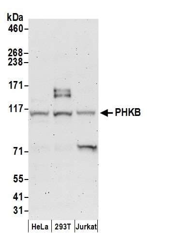 PHKB Antibody (aa650-700)