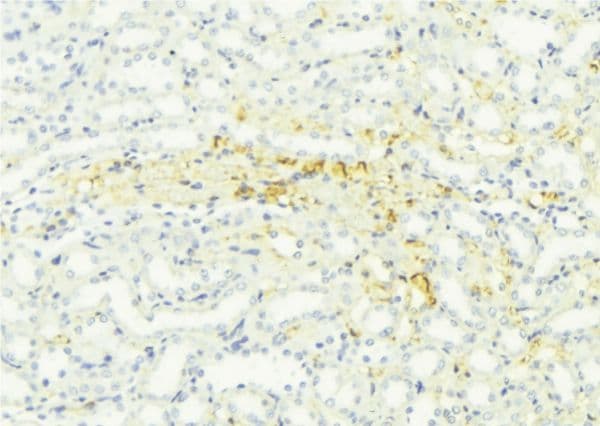 Polyclonal Rabbit anti-Human STAR Antibody (IHC, WB)