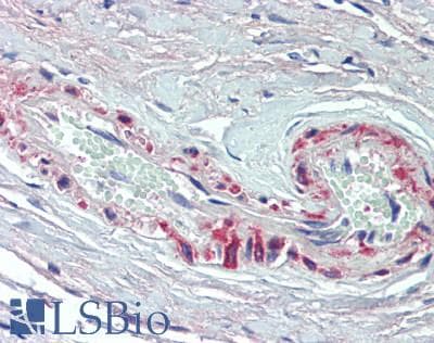 IHC-plus™ Polyclonal Rabbit anti-Human SPRY1 / Sprouty 1 Antibody (IHC, WB)