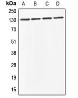 ABL Antibody (C-Terminus)