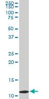 TIMM9 Antibody (clone 1D6)