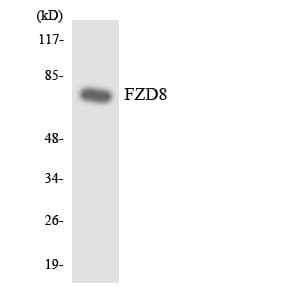 FZD8 / Frizzled 8 Antibody (aa24-73)