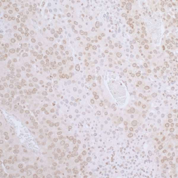 TMPO / TP / Thymopoietin Antibody (aa350-400)