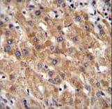 Polyclonal Rabbit anti-Human MIA40 / CHCHD4 Antibody (aa101-129, IHC, WB)