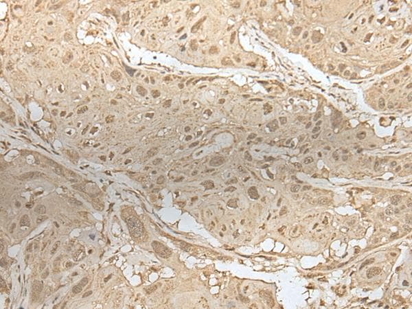 Polyclonal Rabbit anti-Human ZNF238 Antibody (IHC)