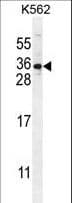 Polyclonal Rabbit anti-Human STARD6 Antibody (aa187-215, WB)