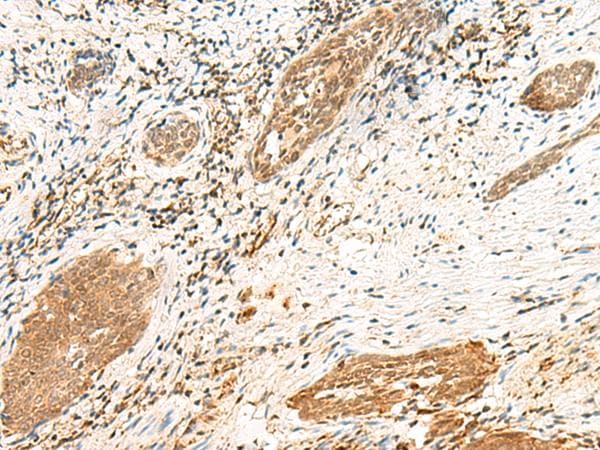 Polyclonal Rabbit anti-Human POLR1D Antibody (IHC)