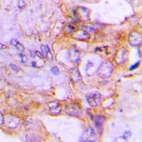 LRPPRC Antibody
