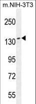 NUP160 Antibody (aa428-455)