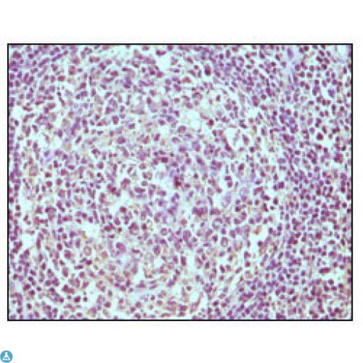 Monoclonal Mouse anti-Human CD19 Antibody (IHC, WB)