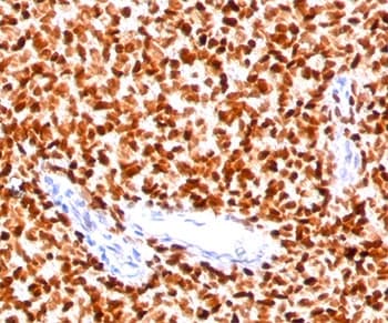 NKX2-2 Antibody (clone NX2/294)