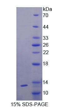 Human IL6R / IL6 Receptor Protein (Recombinant His)