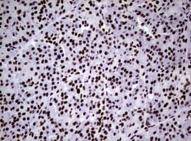 NBN / Nibrin Antibody (clone OTI6E11)