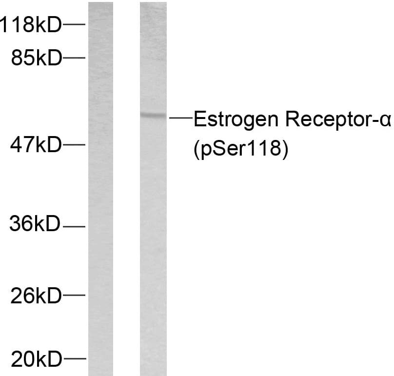 ER Alpha / Estrogen Receptor Antibody (phospho-Ser118)