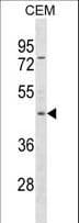 Polyclonal Rabbit anti-Human FOXP3 Antibody (aa397-423, WB)