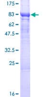 Human LPCAT2 Protein (Recombinant GST)